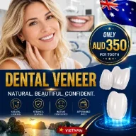 veneers